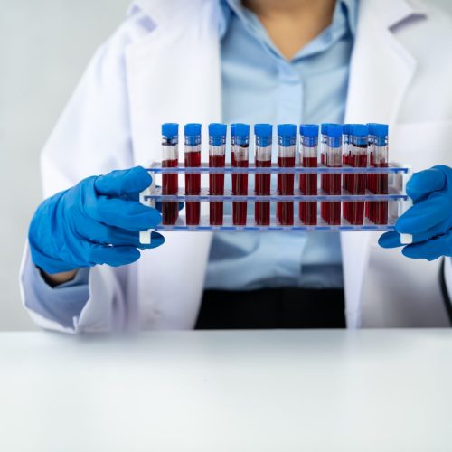 Análises Clínicas